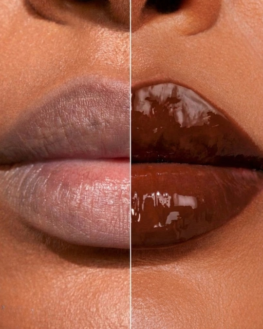 MELANIN MELT™ Hydrating Shea Butter Lip Balm | XoticSista